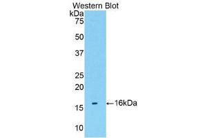 Western Blotting (WB) image for anti-Transmembrane Protein 27 (TMEM27) (AA 17-137) antibody (ABIN1176811) (TMEM27 抗体  (AA 17-137))