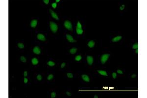 Immunofluorescence of purified MaxPab antibody to ERCC2 on HeLa cell. (ERCC2 抗体  (AA 1-760))