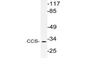 Western blot (WB) analysis of CCS antibody in extracts from Jurkat cells. (Superoxide dismutase copper chaperone 抗体)