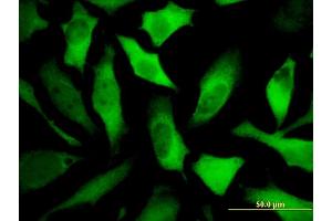 Immunofluorescence of monoclonal antibody to DPYSL5 on HeLa cell. (DPYSL5 抗体  (AA 1-564))