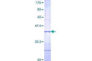 Image no. 1 for Interleukin 1 Receptor-Like 2 (IL1RL2) (AA 20-118) protein (GST tag) (ABIN1307763) (IL1RL2 Protein (AA 20-118) (GST tag))
