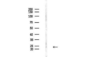 Western blot analysis of lysates from COLO205 cells(heat-shock,45 min treatment), using MRP-L48 Antibody at 1/1000 dilution.