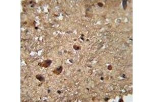 RAN antibody immunohistochemistry analysis in formalin fixed and paraffin embedded human brain tissue. (RAN 抗体  (AA 112-140))