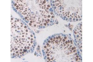 Used in DAB staining on fromalin fixed paraffin- embedded testis tissue (TRERF1 抗体  (AA 785-942))
