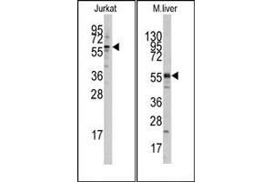 Image no. 1 for anti-K(lysine) Acetyltransferase 5 (KAT5) (N-Term) antibody (ABIN356624) (KAT5 抗体  (N-Term))