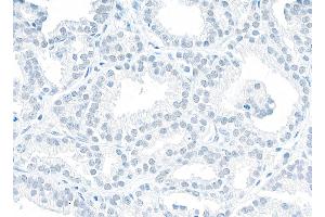 Immunohistochemistry (IHC) image for anti-Non-POU Domain Containing, Octamer-Binding (NONO) (AA 1-50) antibody (ABIN7453849)