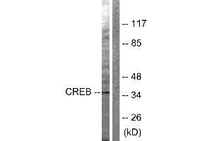 Western blot analysis of extracts from Hela cells treated with PMA (125ng/ml, 30min), using CREB (Ab-142) antibody (#B0006, Line 1 and 2). (CREB1 抗体  (Ser142))