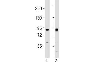 Western blot testing of human 1) HeLa and 2) Jurkat cell lysate with ACO2 antibody at 1:1000. (ACO2 抗体  (AA 294-325))