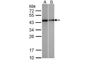 WB Image Sample(30 μg of whole cell lysate) A:A431, B:MOLT4, 12% SDS PAGE antibody diluted at 1:500 (SEPHS1 抗体)
