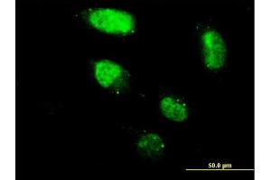 Immunofluorescence of monoclonal antibody to ZNF213 on HeLa cell. (ZNF213 抗体  (AA 133-242))