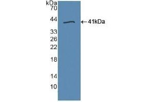 Detection of Recombinant TLR9, Human using Polyclonal Antibody to Toll Like Receptor 9 (TLR9) (TLR9 抗体  (AA 28-362))