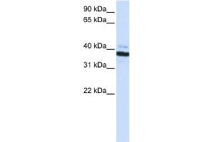 WB Suggested Anti-OAS1 Antibody Titration:  0. (OAS1 抗体  (C-Term))