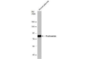 WB Image Human tissue extract (30 μg) was separated by 7. (Prothrombin 抗体  (N-Term))