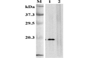 anti-Tumor Necrosis Factor (Ligand) Superfamily, Member 9 (TNFSF9) (Extracellular Domain) antibody