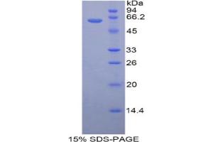 SDS-PAGE analysis of Mouse HSD17b12 Protein. (HSD17B12 蛋白)