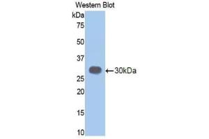 Western blot analysis of the recombinant protein. (Elastase 3B 抗体  (AA 28-267))