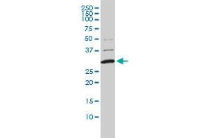 COMT monoclonal antibody (M01), clone 1G4-1A1 Western Blot analysis of COMT expression in A-431 . (COMT 抗体  (AA 1-182))