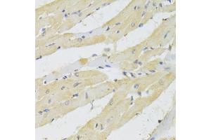 Immunohistochemistry of paraffin-embedded rat heart using TRAP1 Antibody (ABIN5971463) at dilution of 1/100 (40x lens). (TRAP1 抗体)