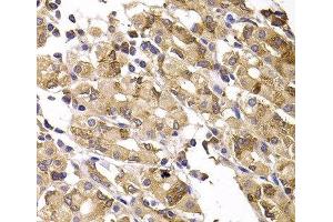 Immunohistochemistry of paraffin-embedded Human gastric damage using ASMTL Polyclonal Antibody at dilution of 1:100 (40x lens).