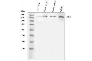 Western blot analysis of FASN using anti-FASN antibody (ABIN3044520). (Fatty Acid Synthase 抗体  (AA 1-226))