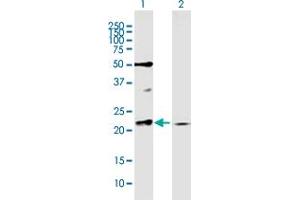 Western Blot analysis of RAB11A expression in transfected 293T cell line by RAB11A MaxPab polyclonal antibody. (RAB11A 抗体  (AA 1-216))