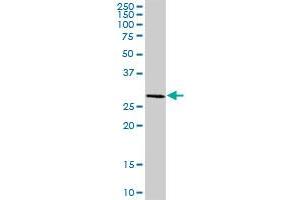 HSD17B8 MaxPab polyclonal antibody. (HSD17B8 抗体  (AA 1-261))