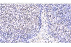 Detection of S100Z in Human Lymph node Tissue using Polyclonal Antibody to S100 Calcium Binding Protein Z (S100Z) (S100Z 抗体  (AA 1-99))