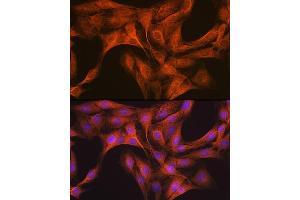 Immunofluorescence analysis of C6 cells using CLOCK Rabbit mAb (ABIN7266414) at dilution of 1:100 (40x lens). (CLOCK 抗体)