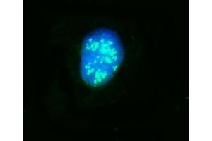 IF analysis of NOP58 using anti-NOP58 antibody (ABIN7601224).