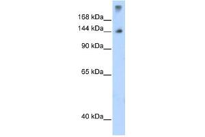 WB Suggested Anti-SF3B1 Antibody Titration:  1. (SF3B1 抗体  (N-Term))