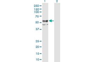 Western Blot analysis of CHST12 expression in transfected 293T cell line by CHST12 MaxPab polyclonal antibody. (CHST12 抗体  (AA 1-414))