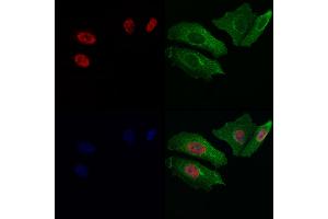 ABIN7093972 and ABIN7098016 staining Hela cells by IF/ICC. (Retinoic Acid Receptor gamma 抗体  (N-Term))