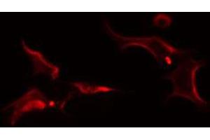 ABIN6274256 staining Hela cells by IF/ICC. (FRK 抗体  (Internal Region))
