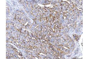 IHC analysis of ENPP1/PC1 using anti-ENPP1/PC1 antibody (ABIN7601410).