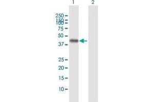 Western Blot analysis of LECT1 expression in transfected 293T cell line by LECT1 MaxPab polyclonal antibody. (LECT1 抗体  (AA 1-334))