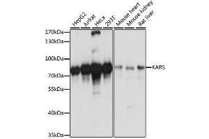 Western blot analysis of extracts of various cell lines, using KARS antibody. (KARS 抗体  (AA 298-597))