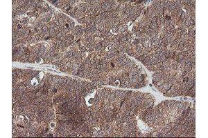 Image no. 6 for anti-V-Ets Erythroblastosis Virus E26 Oncogene Homolog 2 (ETS2) (AA 90-349) antibody (ABIN1491702)