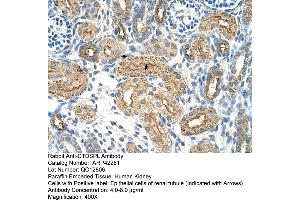 Rabbit Anti-CTDSPL Antibody  Paraffin Embedded Tissue: Human Kidney Cellular Data: Epithelial cells of renal tubule Antibody Concentration: 4. (CTDSPL 抗体  (N-Term))