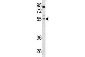PAX7 antibody western blot analysis in CEM lysate (PAX7 抗体  (AA 181-210))