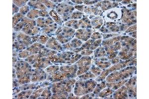 Immunohistochemical staining of paraffin-embedded Kidney tissue using anti-PRKAR2A mouse monoclonal antibody. (PRKAR2A 抗体)