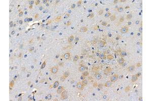 ABIN6257484 and ABIN6274780 at 1/100 staining Rat brain tissue by IHC-P. (RPL35 抗体  (C-Term))