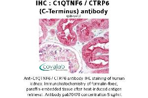 Image no. 2 for anti-Complement C1q Tumor Necrosis Factor-Related Protein 6 (C1QTNF6) antibody (ABIN1732486) (CTRP6 抗体)