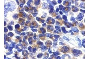 Immunohistochemistry of DAPK2 in mouse spleen cells with DAPK2 antibody at 2 μg/ml. (DAPK2 抗体)
