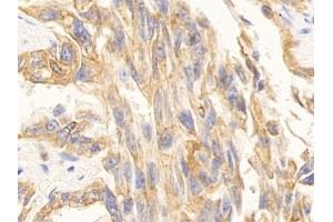 Immunohistochemistry (IHC) image for anti-Keratin 10 (KRT10) (AA 153-456) antibody (ABIN7433948)