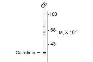 Western blots of rat cerebellum (CB) lysate showing specific immunolabeling of the ~ 29k calretinin protein.