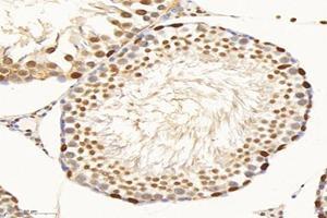 Immunohistochemistry analysis of paraffin-embedded rat testis using,SET (ABIN7075583) at dilution of 1: 10000 (SET/TAF-I 抗体)