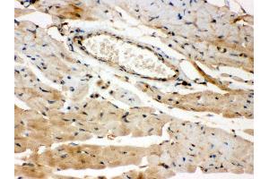 Anti- ROCK2 Picoband antibody,IHC(P) IHC(P): Mouse Cardiac Muscle Tissue (ROCK2 抗体  (AA 652-923))