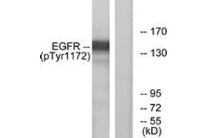 Western blot analysis of extracts from A431 cells treated with EGF 40 muM 10', using EGFR (Phospho-Tyr1172) Antibody. (EGFR 抗体  (pTyr1172))