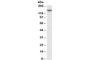 Western blot testing of Jurkat nuclear lysate with NFATC3 antibody at 0. (NFATC3 抗体)