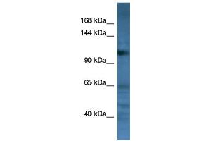 WB Suggested Anti-CD22 Antibody Titration: 0. (CD22 抗体  (C-Term))